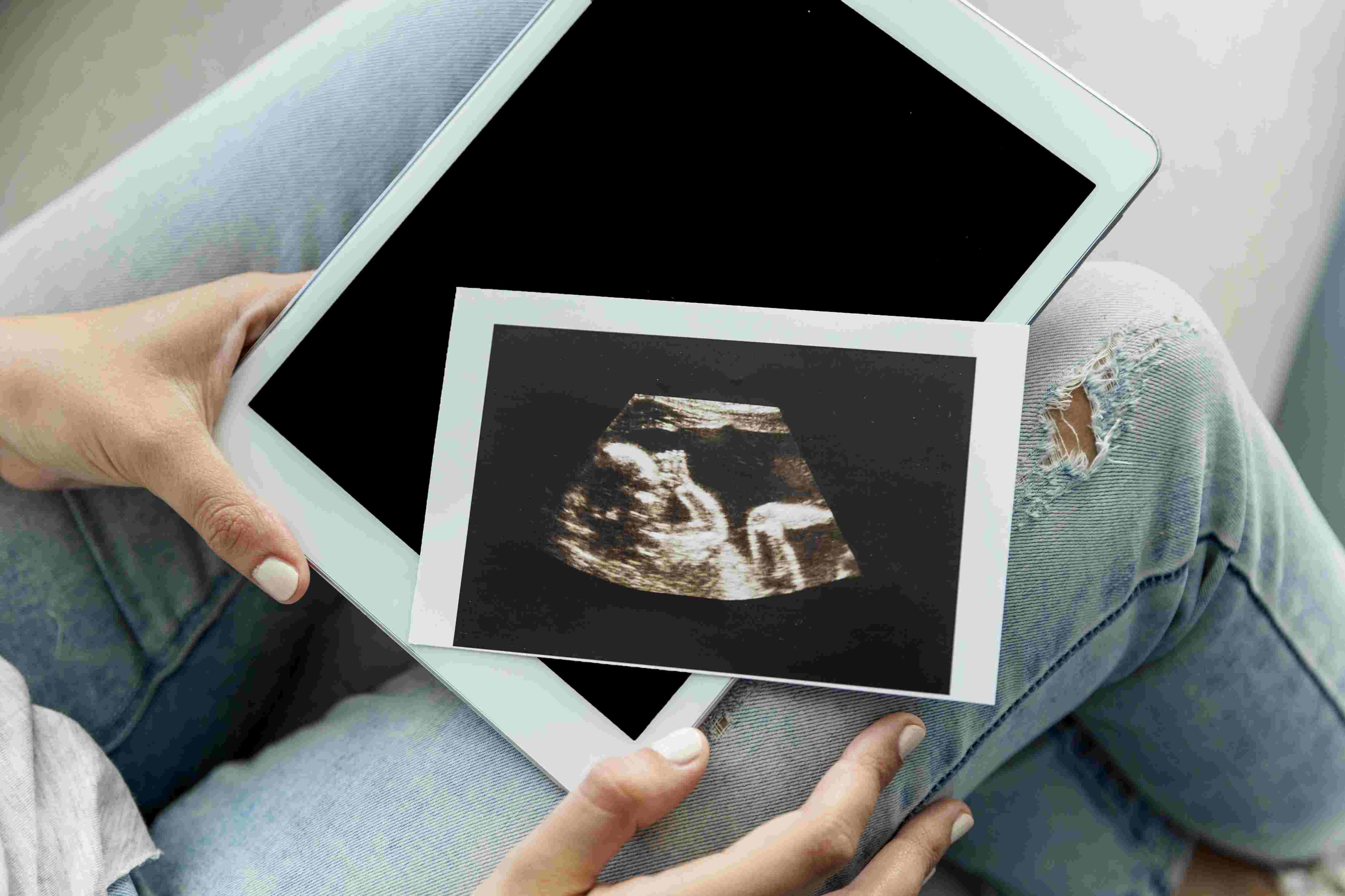Fetal Echo