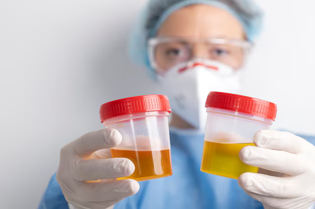 Burning Urination / Blood in Urine