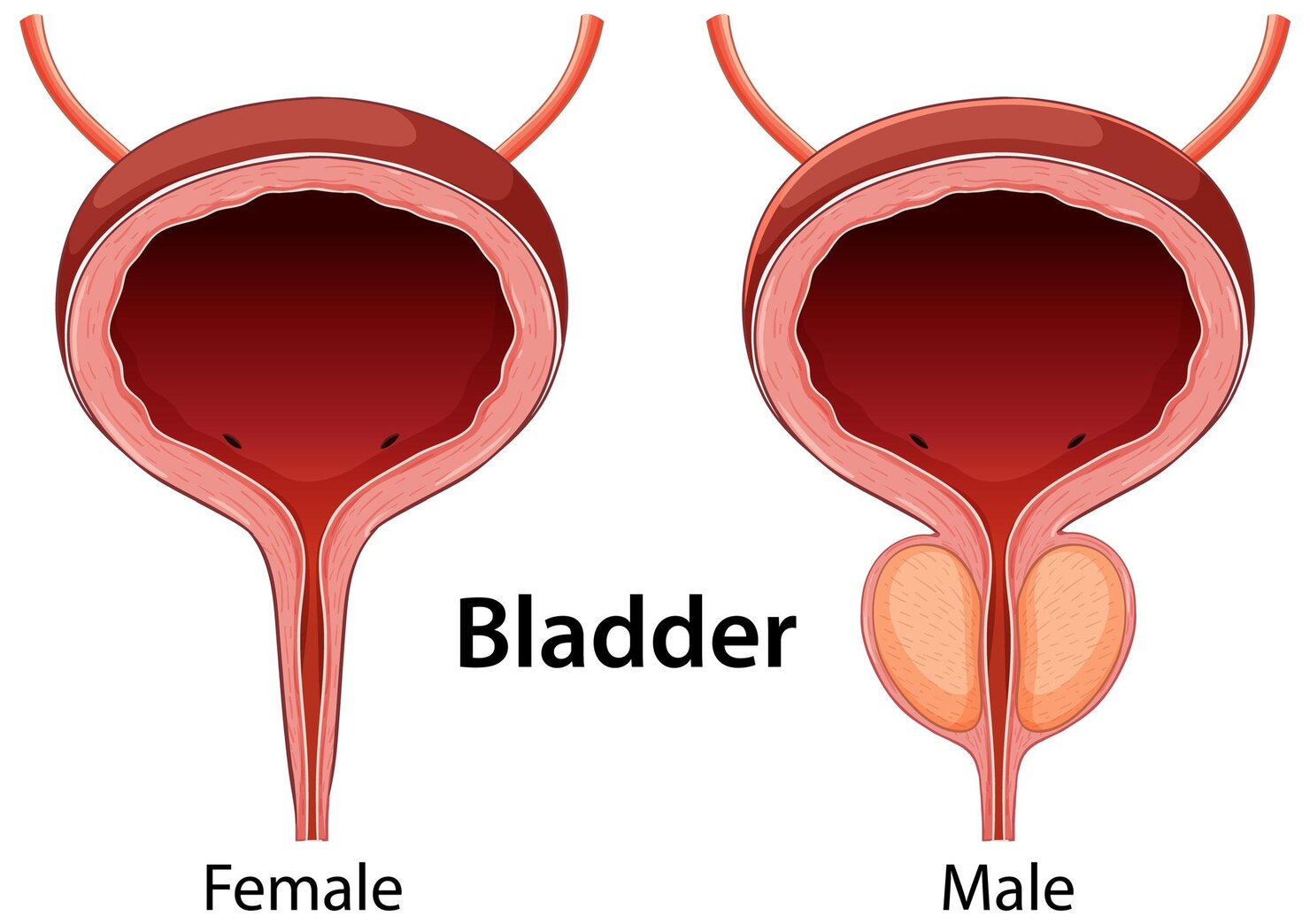 Stricture Urethra
