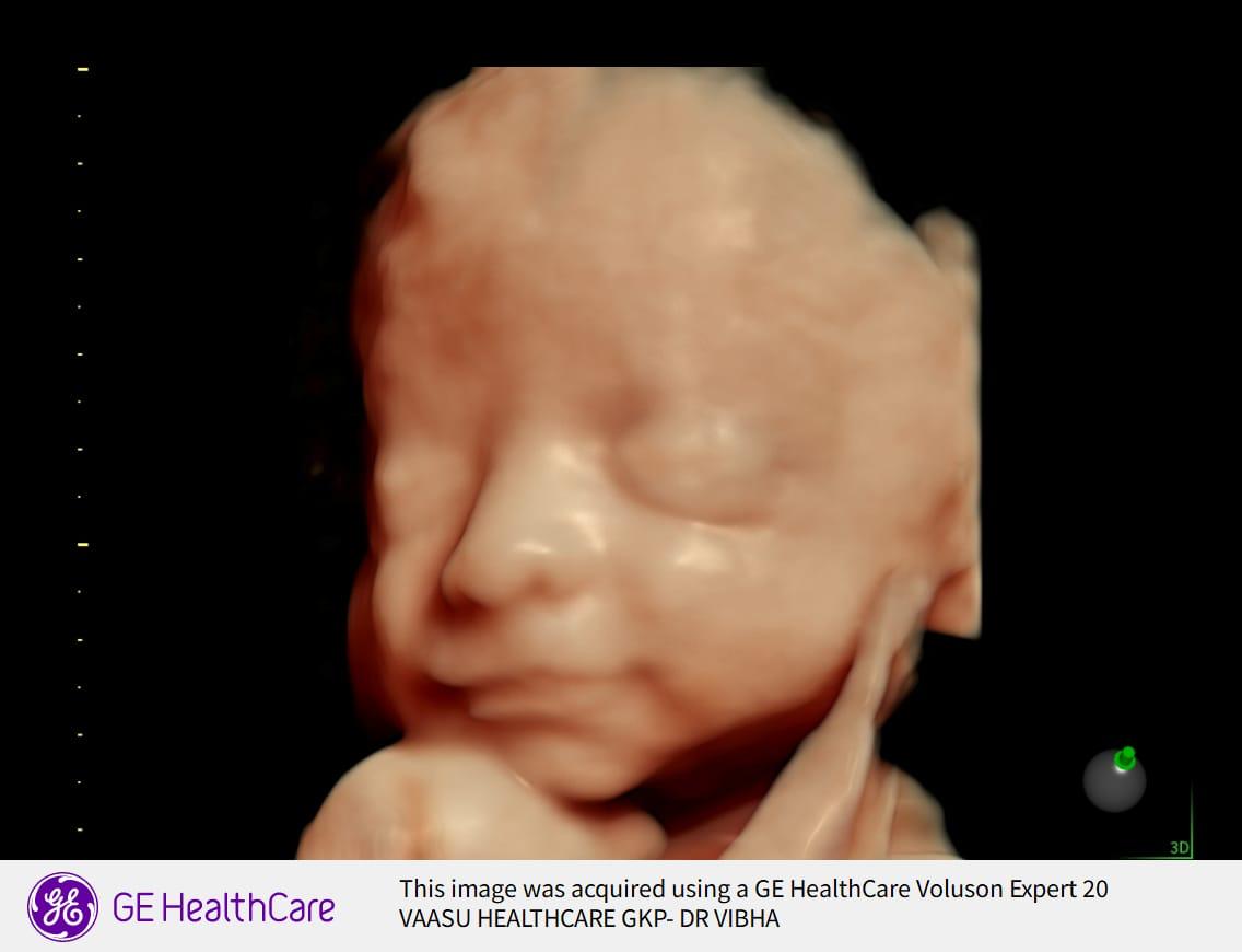 TIFFA Scan (Level 2)